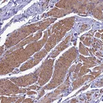 Atlas Antibodies Anti-NKD1 Antibody
