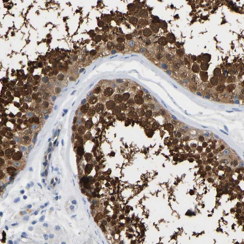 Atlas Antibodies Anti-NKAIN3 Antibody