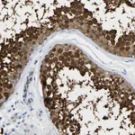 Atlas Antibodies Anti-NKAIN3 Antibody