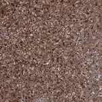 Atlas Antibodies Anti-NIT2 Antibody