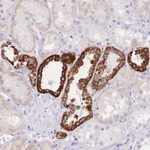 Atlas Antibodies Anti-NKD2 Antibody