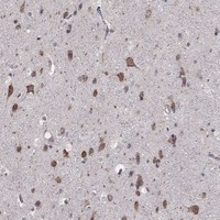 Atlas Antibodies Anti-NKIRAS1 Antibody
