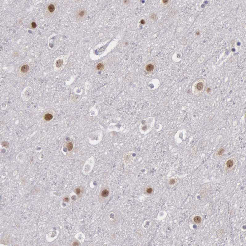 Atlas Antibodies Anti-NKAP Antibody