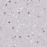 Atlas Antibodies Anti-NKAP Antibody