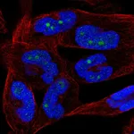 Atlas Antibodies Anti-NKIRAS2 Antibody