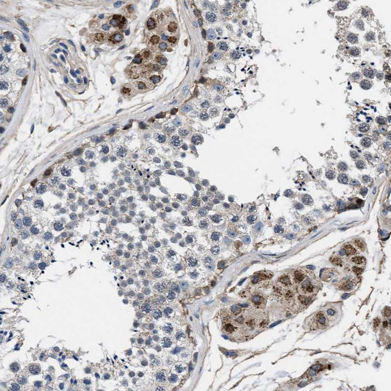 Atlas Antibodies Anti-NKTR Antibody