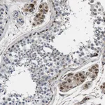 Atlas Antibodies Anti-NKTR Antibody