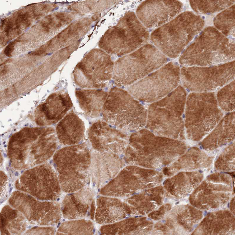 Atlas Antibodies Anti-NKX2-3 Antibody