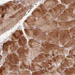 Atlas Antibodies Anti-NKX2-3 Antibody