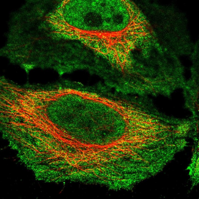 Atlas Antibodies Anti-NKTR Antibody