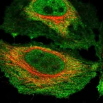 Atlas Antibodies Anti-NKTR Antibody