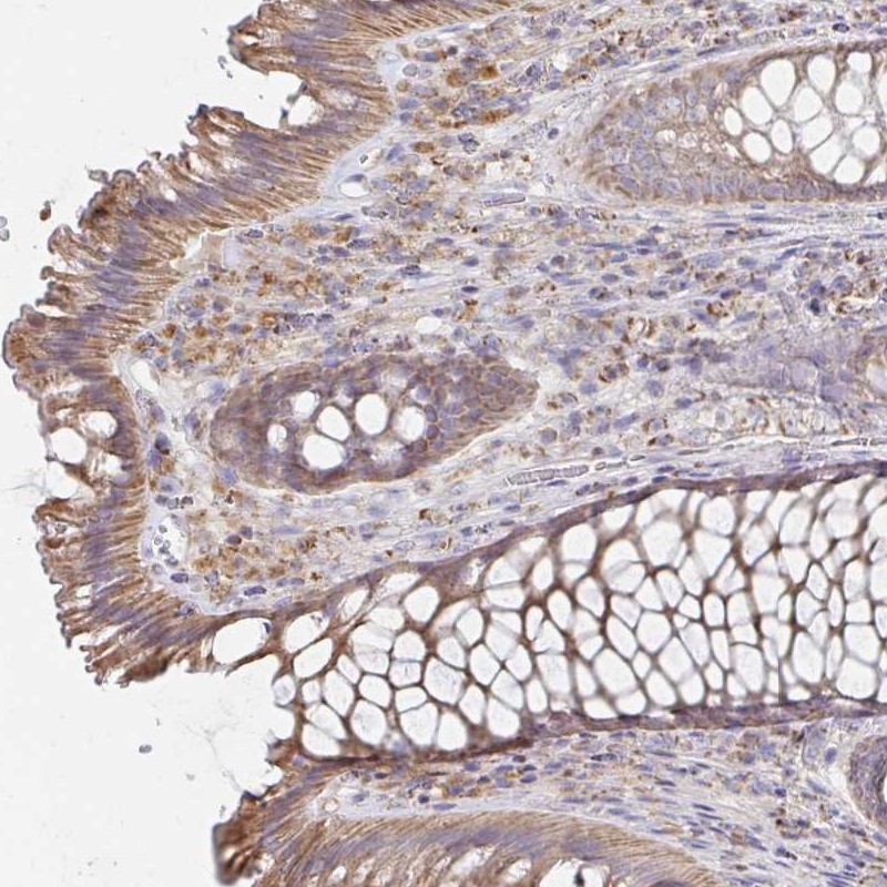 Atlas Antibodies Anti-NKX2-8 Antibody