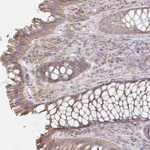 Atlas Antibodies Anti-NKX2-8 Antibody