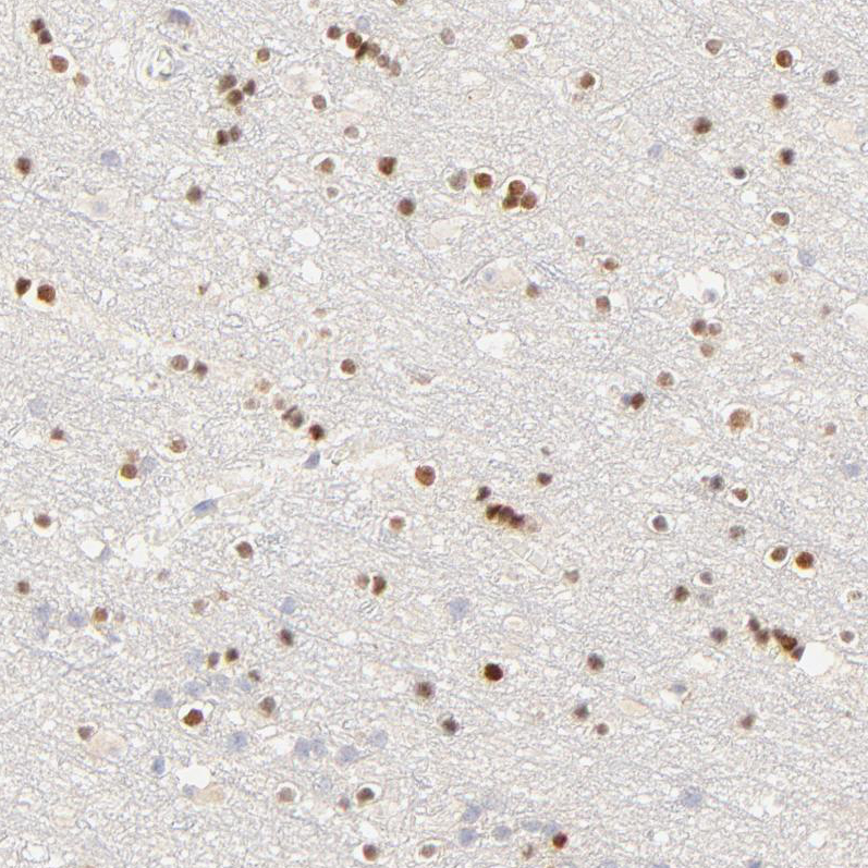 Atlas Antibodies Anti-NKX2-2 Antibody