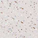 Atlas Antibodies Anti-NKX2-2 Antibody