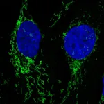 Atlas Antibodies Anti-NLGN2 Antibody