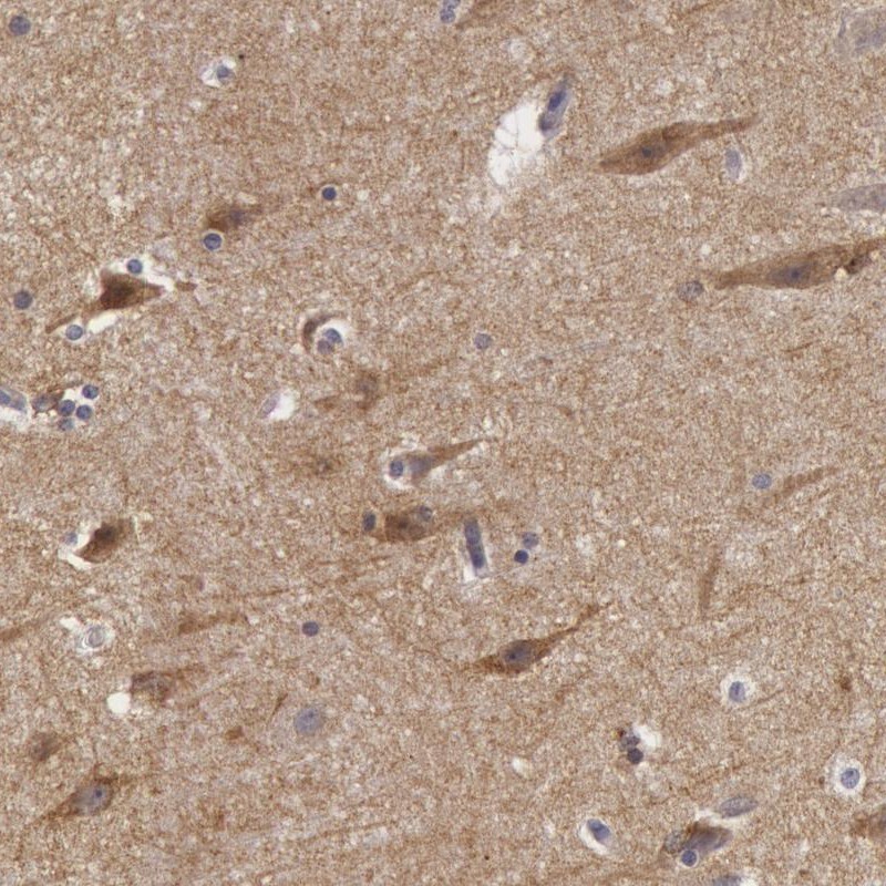 Atlas Antibodies Anti-NLGN4X Antibody