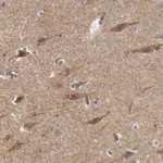 Atlas Antibodies Anti-NLGN4X Antibody
