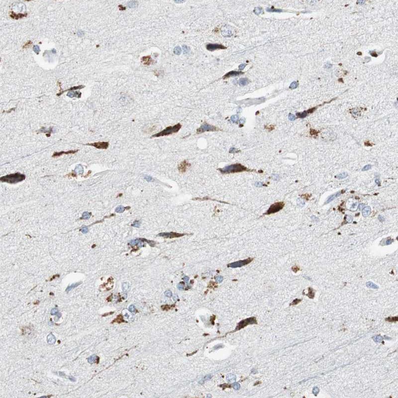 Atlas Antibodies Anti-NLGN1 Antibody