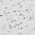 Atlas Antibodies Anti-NLGN1 Antibody