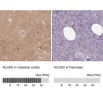 Atlas Antibodies Anti-NLGN2 Antibody
