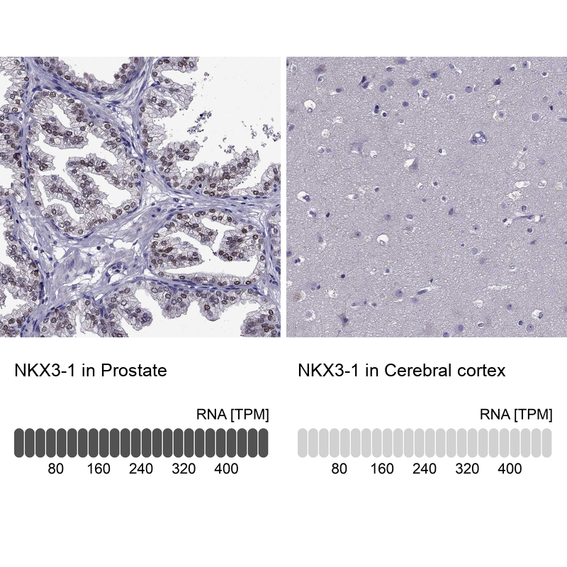 Atlas Antibodies Anti-NKX3-1 Antibody