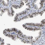 Atlas Antibodies Anti-NLE1 Antibody