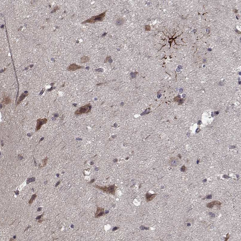 Atlas Antibodies Anti-NLK Antibody