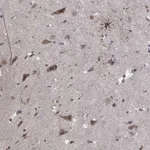 Atlas Antibodies Anti-NLK Antibody