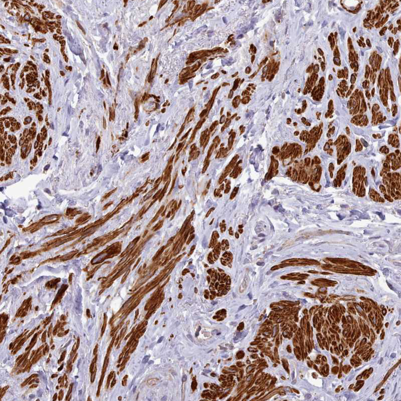 Atlas Antibodies Anti-NLRC4 Antibody