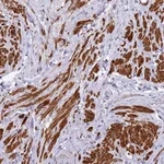 Atlas Antibodies Anti-NLRC4 Antibody