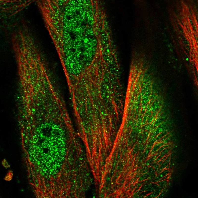 Atlas Antibodies Anti-NLRP1 Antibody