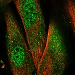Atlas Antibodies Anti-NLRP1 Antibody