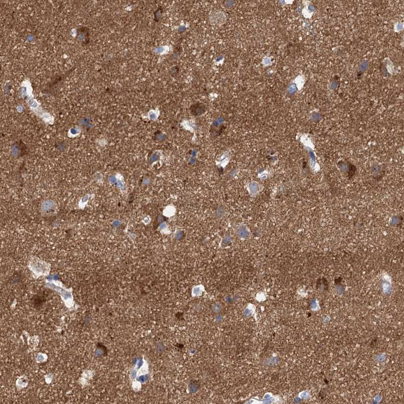 Atlas Antibodies Anti-NLRP10 Antibody