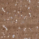 Atlas Antibodies Anti-NLRP10 Antibody