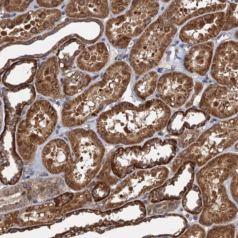 Atlas Antibodies Anti-NLRP10 Antibody