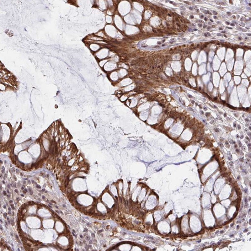 Atlas Antibodies Anti-NLRP13 Antibody