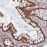 Atlas Antibodies Anti-NLRP13 Antibody