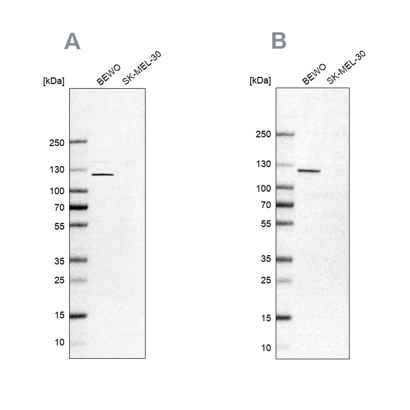 Atlas Antibodies Anti-NLRP2 Antibody