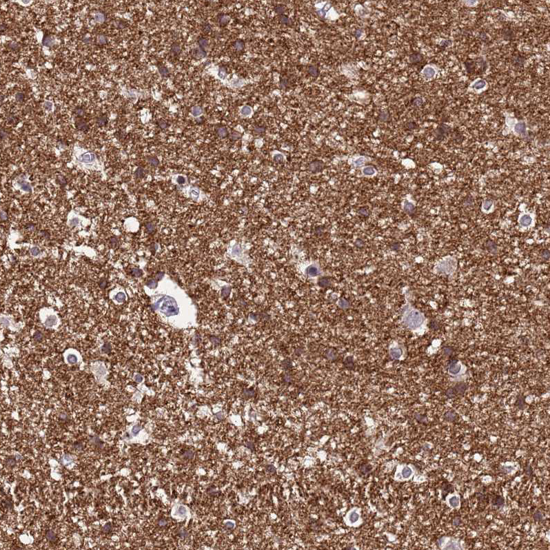 Atlas Antibodies Anti-NLRP11 Antibody