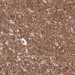 Atlas Antibodies Anti-NLRP11 Antibody