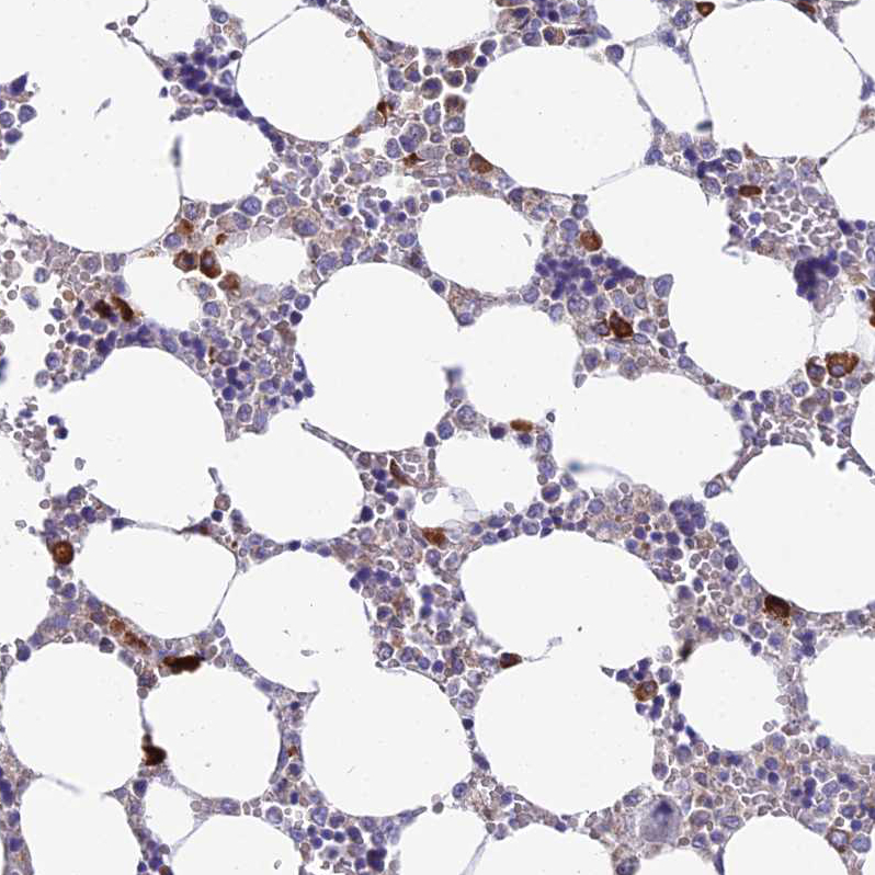 Atlas Antibodies Anti-NLRP12 Antibody
