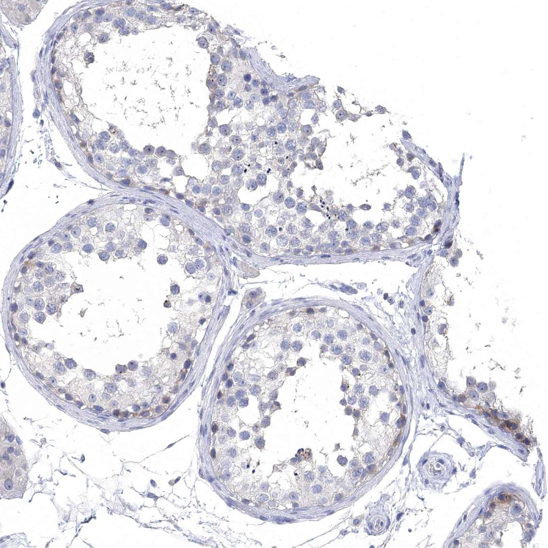 Atlas Antibodies Anti-NLRP14 Antibody