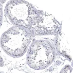Atlas Antibodies Anti-NLRP14 Antibody