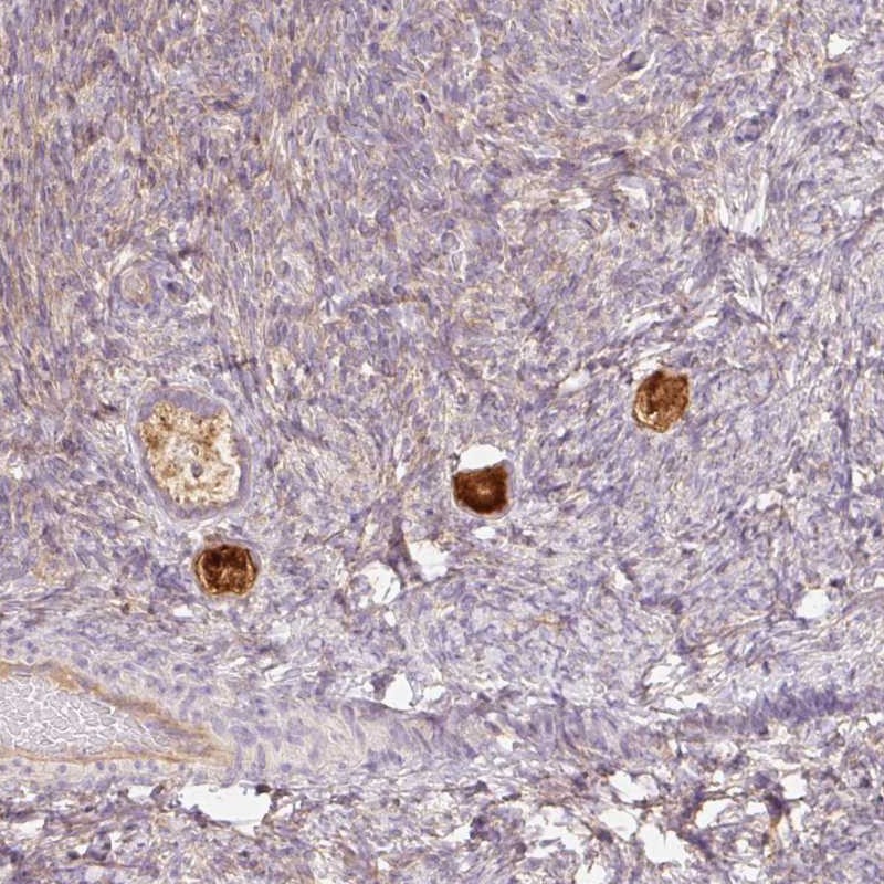 Atlas Antibodies Anti-NLRP5 Antibody