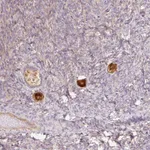 Atlas Antibodies Anti-NLRP5 Antibody