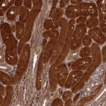 Atlas Antibodies Anti-NLRP7 Antibody