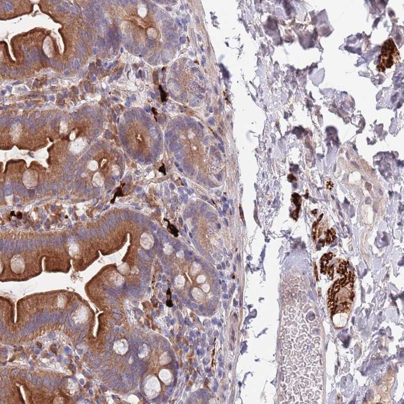 Atlas Antibodies Anti-NLRP6 Antibody
