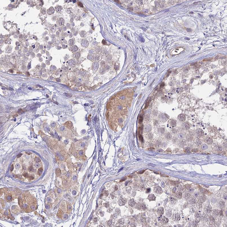 Atlas Antibodies Anti-NLRP9 Antibody