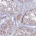 Atlas Antibodies Anti-NLRP9 Antibody